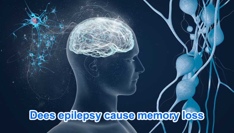 Does Epilepsy cause memory loss