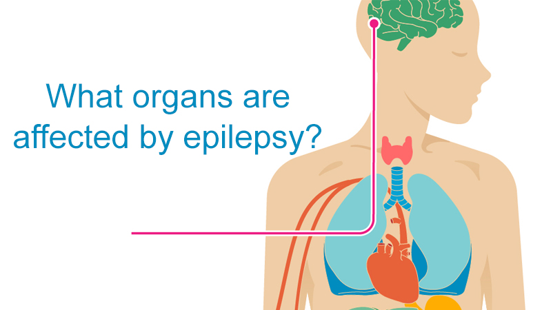 What organs are affected by epilepsy?